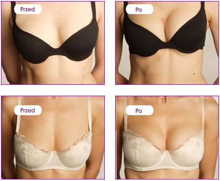 Żel do biustu Perfect Bust - kuracja ujędrniająca, 150 ml — zdjęcie 3