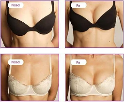 Żel do biustu Perfect Bust - kuracja ujędrniająca, 150 ml — zdjęcie 3