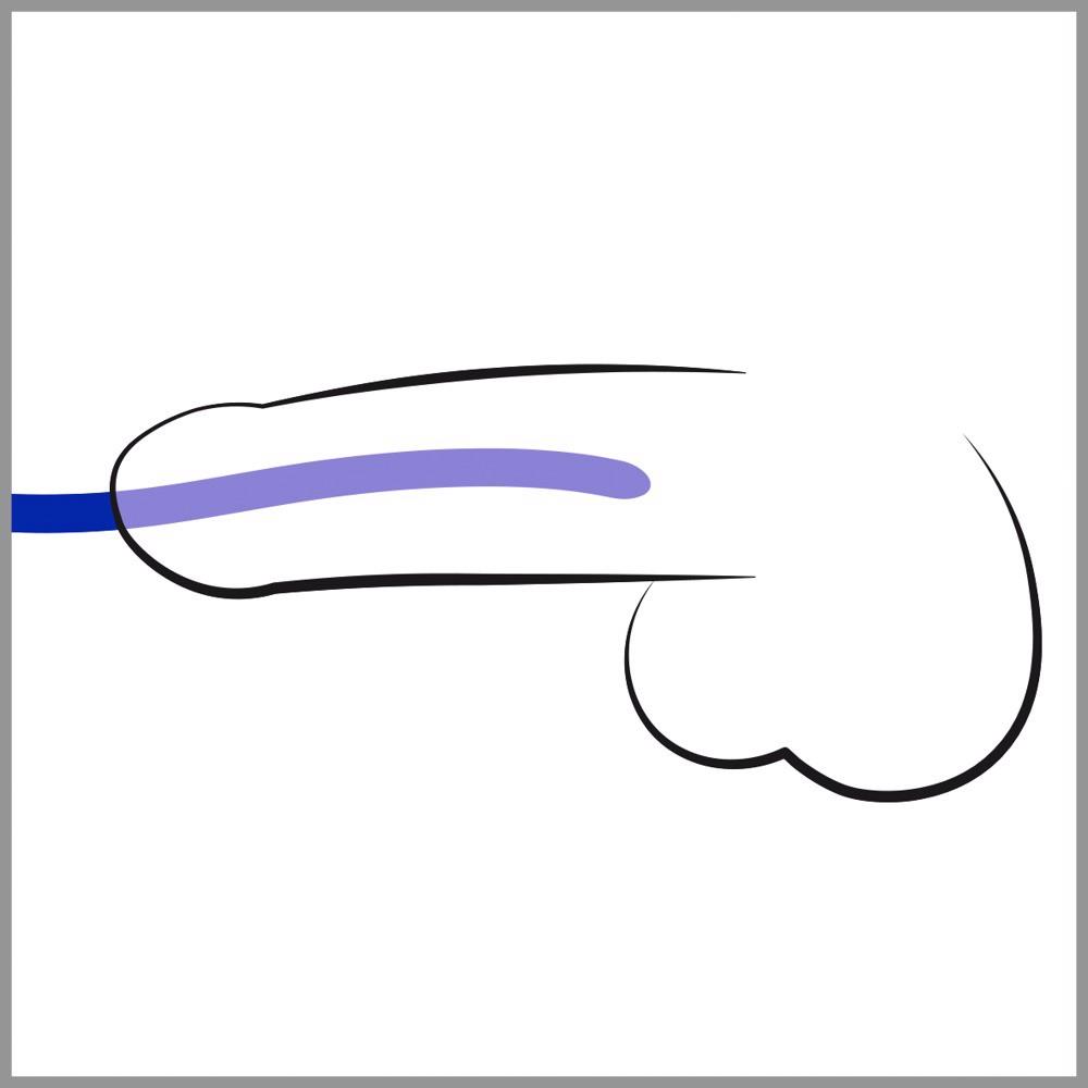 Zestaw rozszerzaczy cewki moczowej Silicone Dilator Set – 3 szt. — zdjęcie 2
