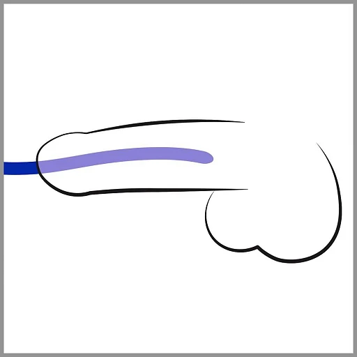 Zestaw rozszerzaczy cewki moczowej Silicone Dilator Set – 3 szt. — zdjęcie 2